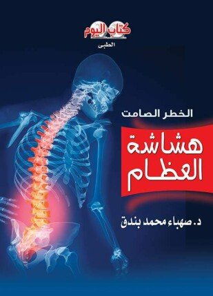 تحميل وقراءة كتاب هشاشة العظام الخطر الصامت تأليف صهباء بندق pdf مجانا